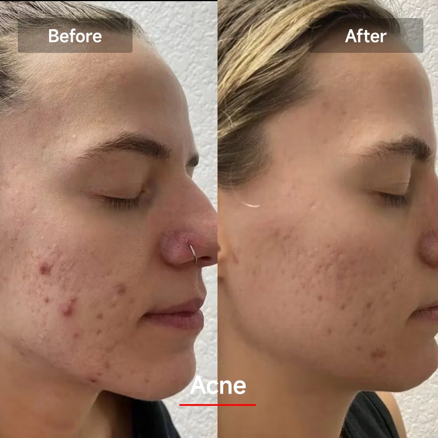 LED Red Light Therapy Mask