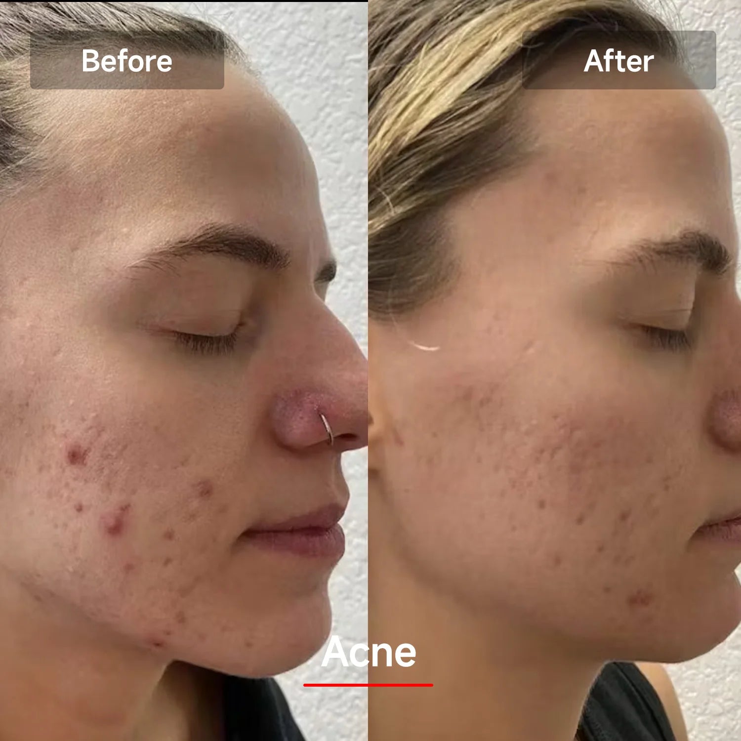 LED Red Light Therapy Mask