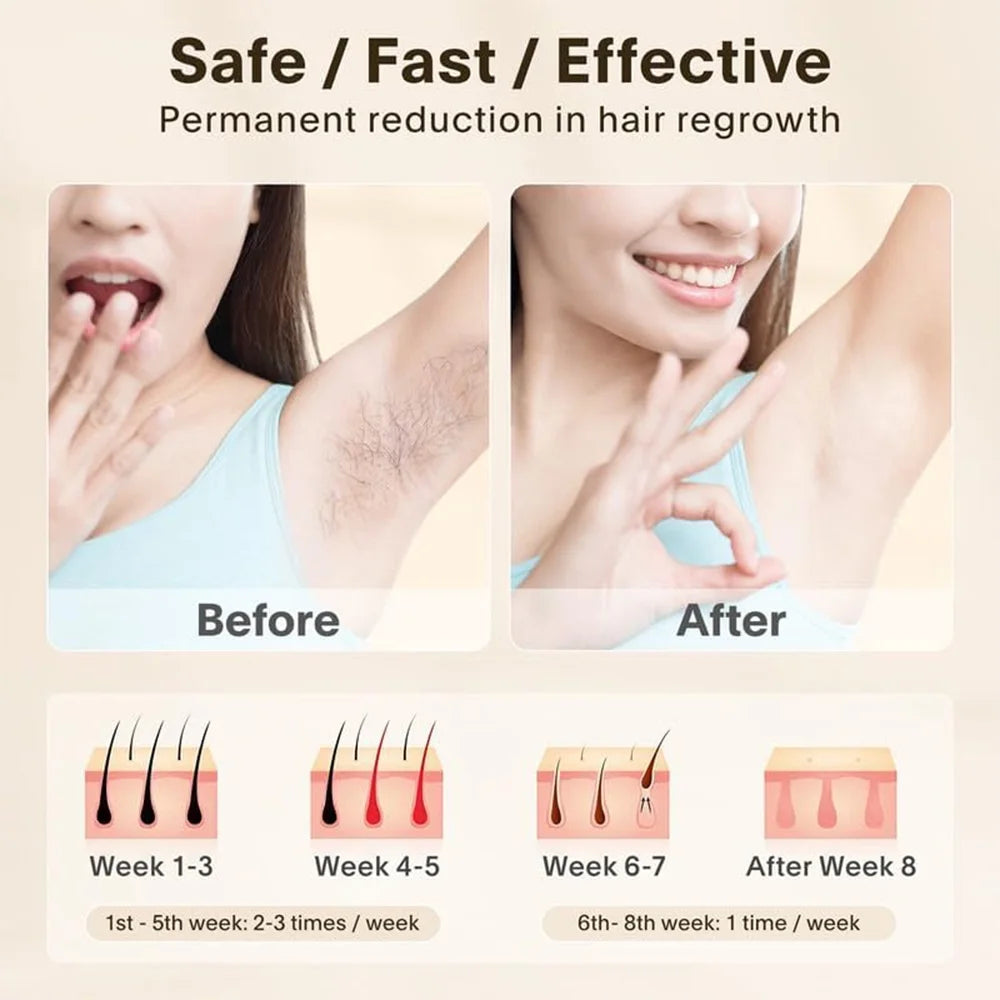 Laser Hair Removal for Women and Men, Hair Removal Device for Body,Best Gift