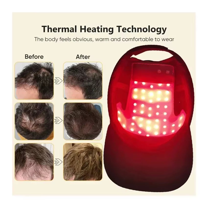 LED Red Light Therapy Cap Hair Growth Helmet Diode Laserhat Light Therapy Cap for Hair Regrowth and Hair Loss Treatment