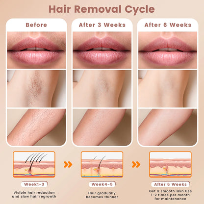 Laser Hair Removal,  IPL Hair Removal Device for Women and Men, 999999 Flashes for Arm Leg